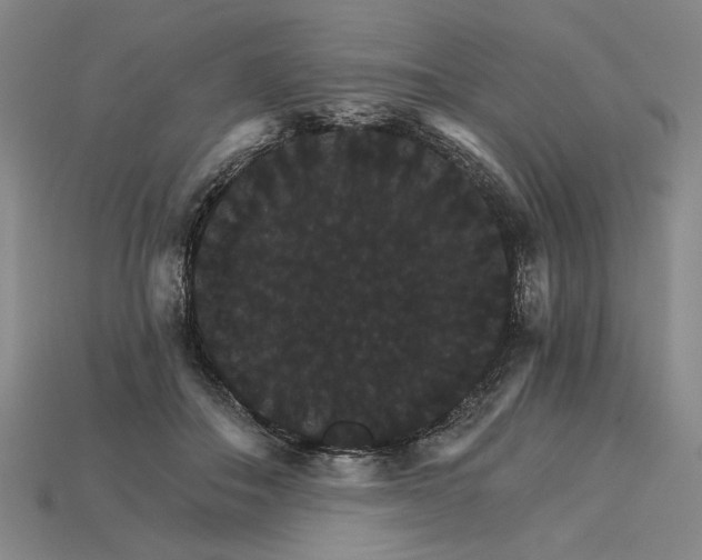 X0000115270506200911131810