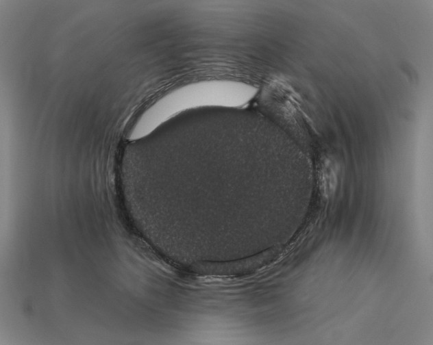 X0000115270516200911131810