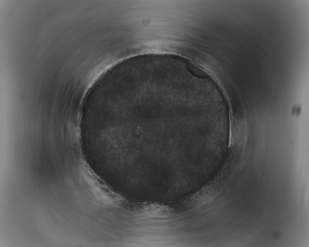 X0000115280387200911201757