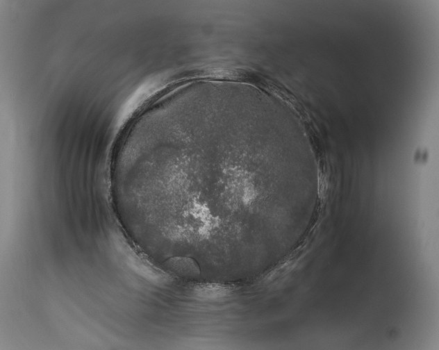 X0000115300198200911161705