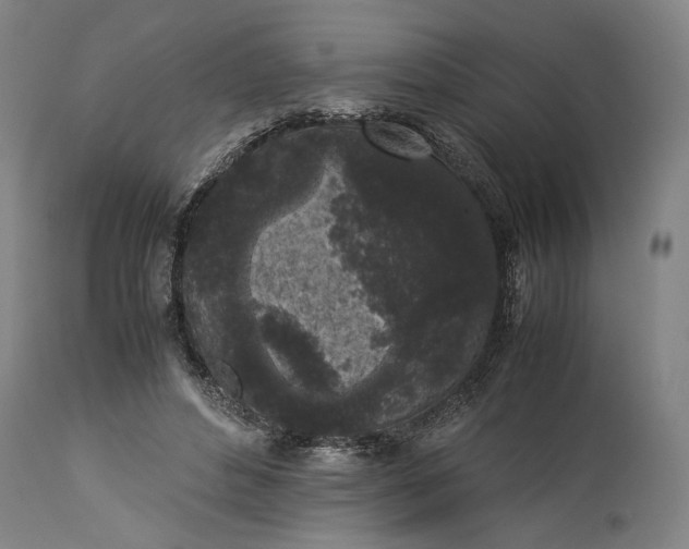 X0000115300496200911161701