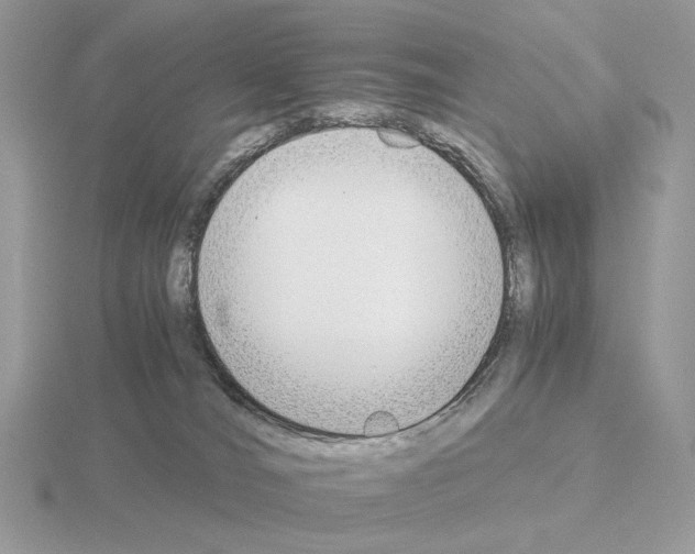 X0000115300036200912141125
