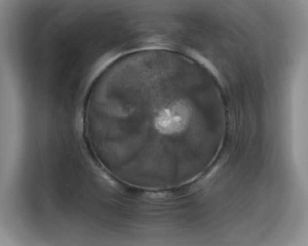X0000115311415200911091127