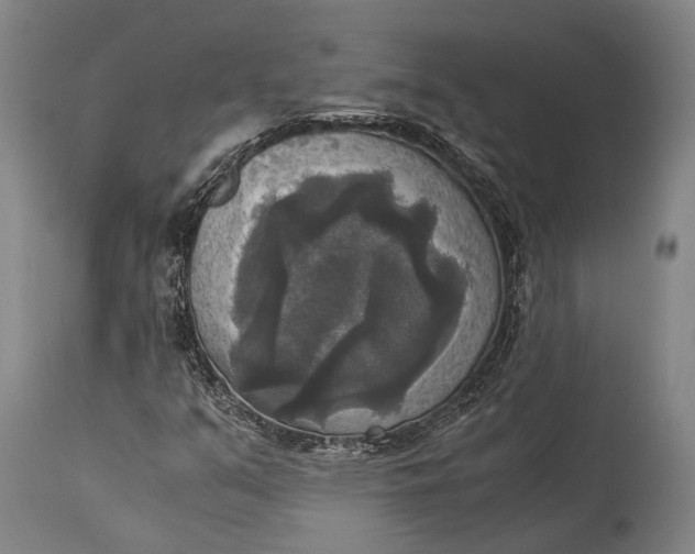 X0000115311351200911161711