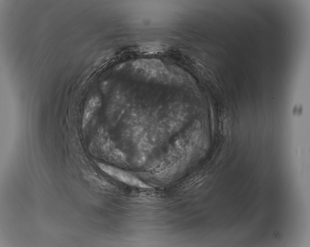 X0000115311393200911161710