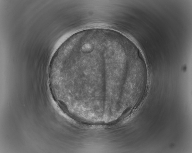 X0000115311389200911301525