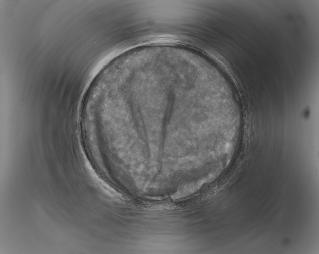 X0000115311475200911301524