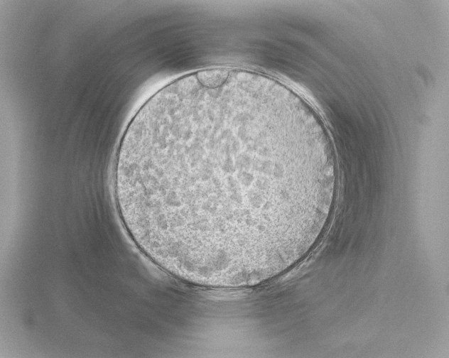 X0000115311440200912141128