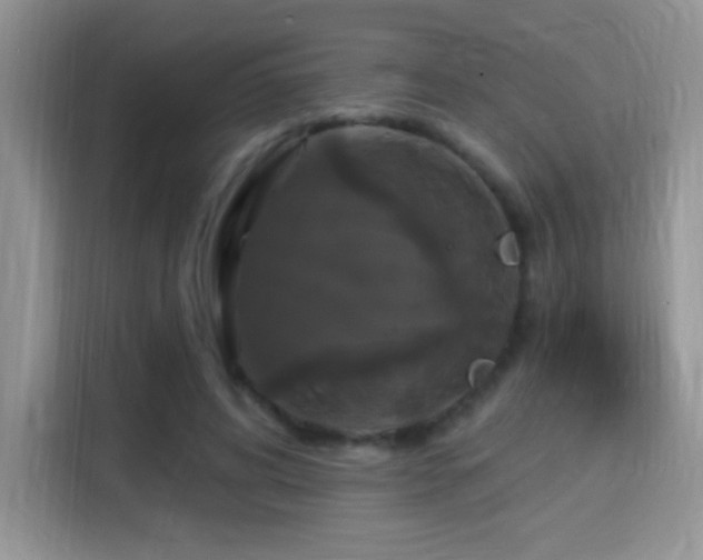 X0000115320592200911091158