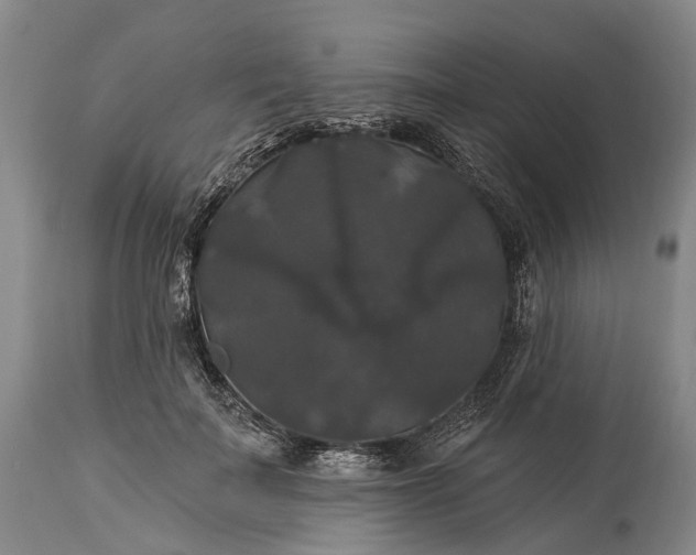 X0000115320699200911161745