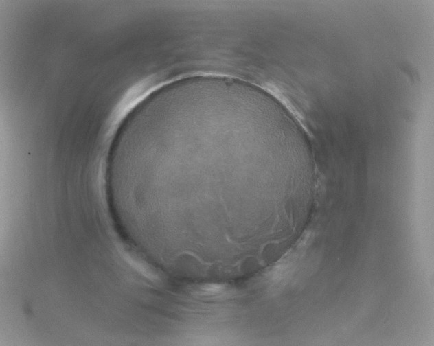 X0000115320151200911231358