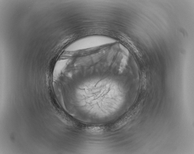 X0000115320161200912141205