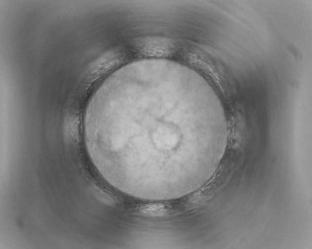 X0000115320162200912141205