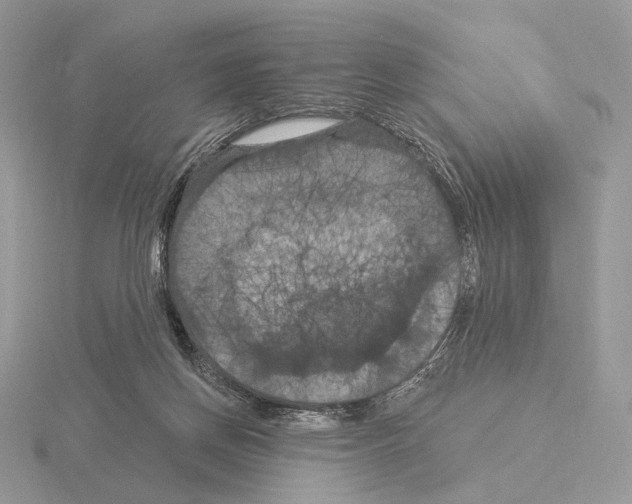 X0000115320166200912141205