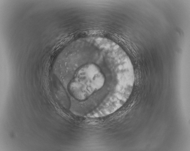 X0000115320913200912141155