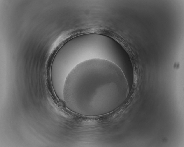 X0000115330198200911161817