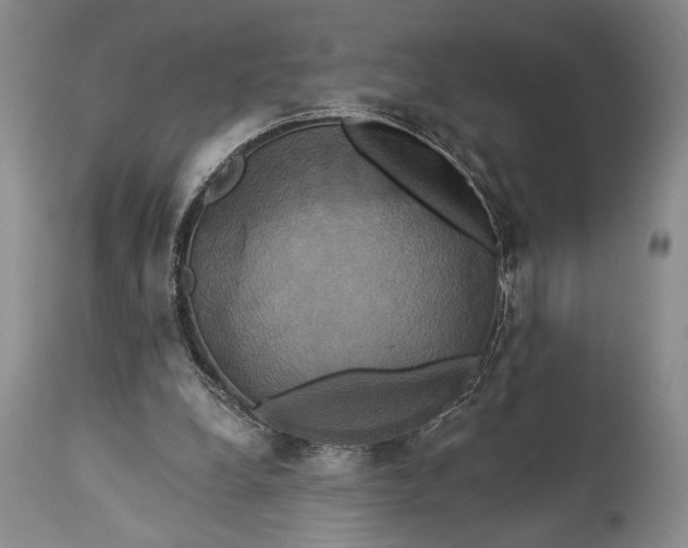 X0000115330248200911161815