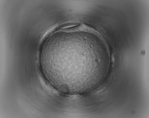 X0000115330396200911161814