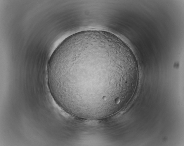 X0000115331006200911161804