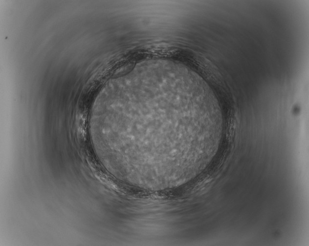 X0000115331010200911161803