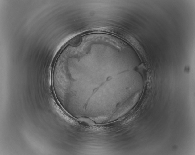 X0000115331036200911161804