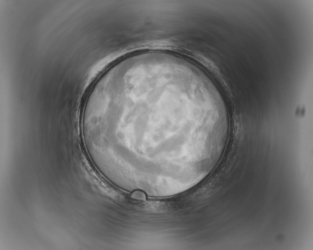 X0000115331176200911161802