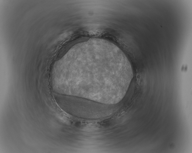 X0000115331249200911161800