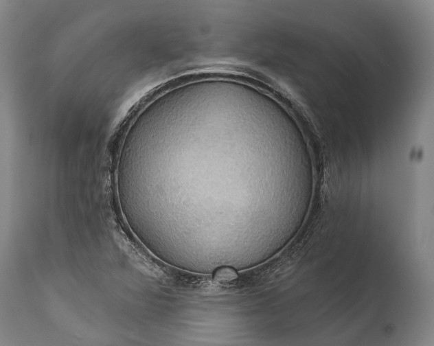 X0000115331360200911161759