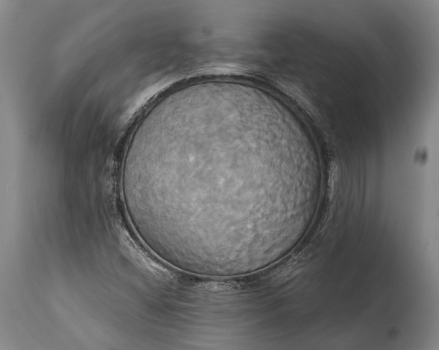 X0000115331404200911161758