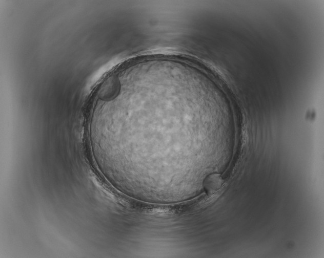 X0000115331406200911161758