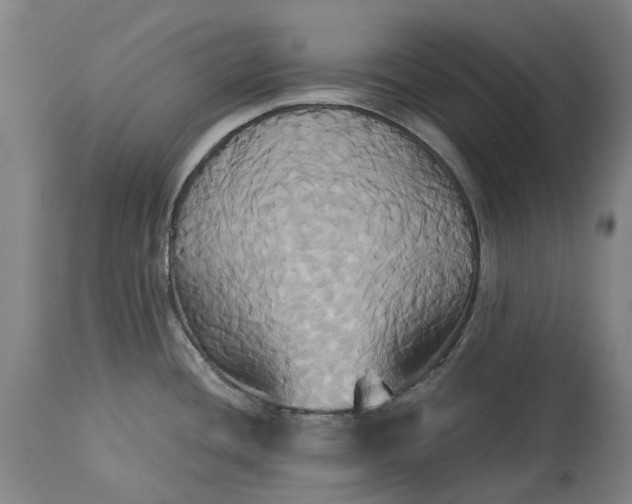 X0000115331436200911161758