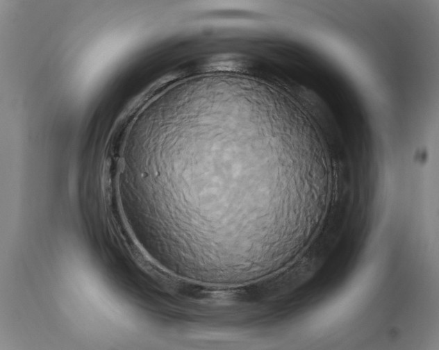 X0000115331438200911161758
