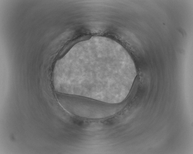 X0000115331249200911231404