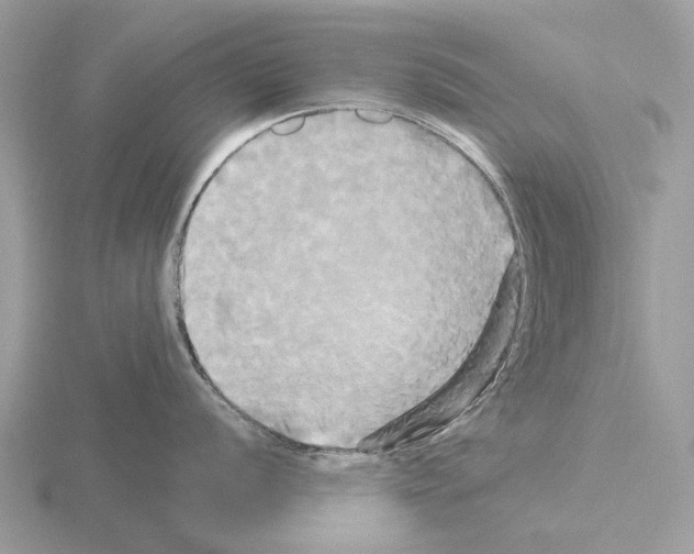 X0000115331056200912141215