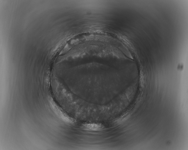 X0000115340449200911161836