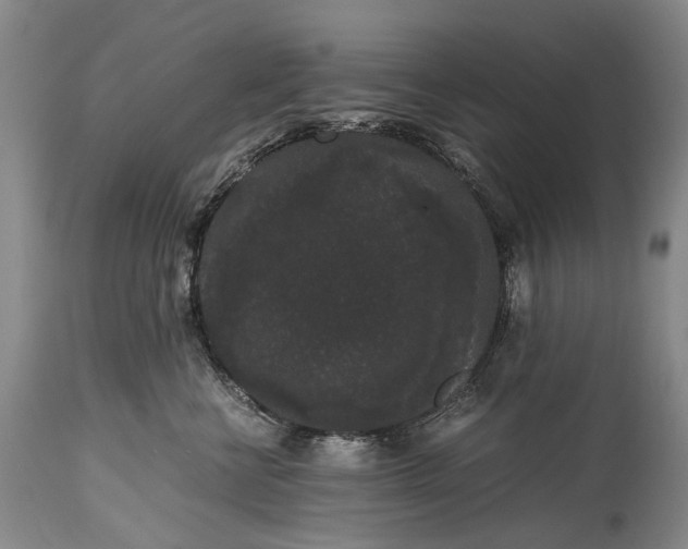 X0000115340570200911161835