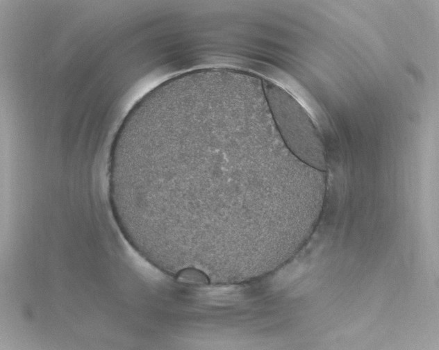 X0000115341143200911231427