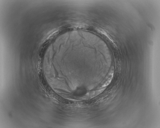 X0000115351399200912011042