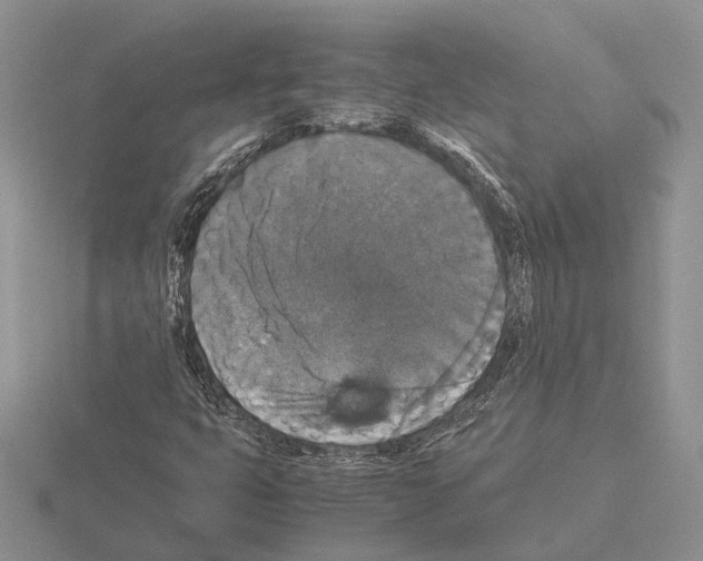 X0000115351399200912151327