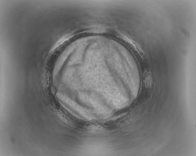X0000115361448200912011103