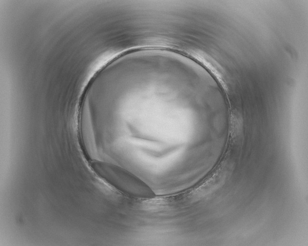 X0000115361477200912011103