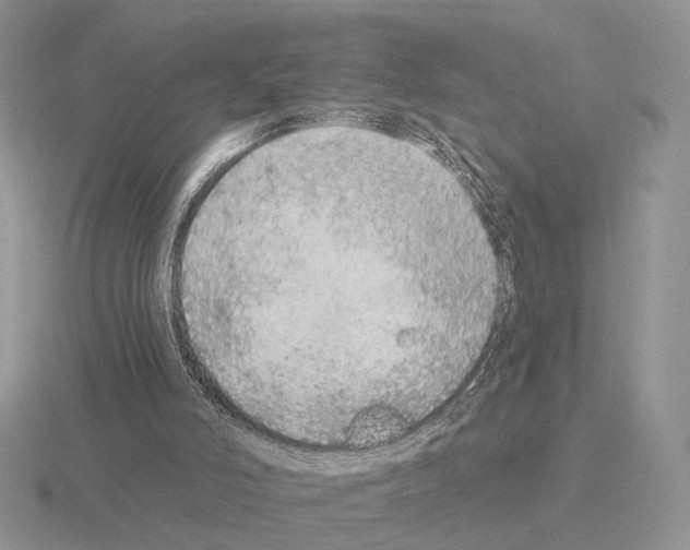 X0000115360006200912151407