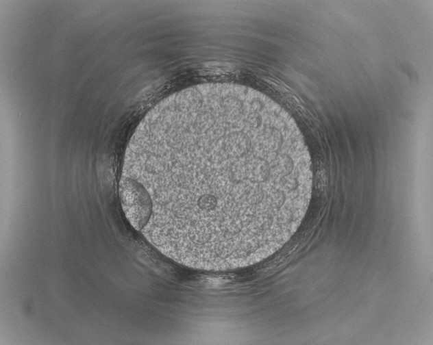 X0000115370662200912151420