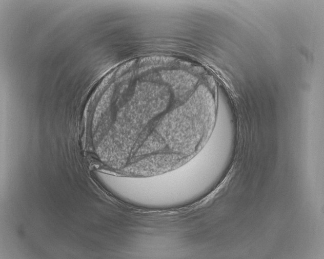 X0000115371449200912151409