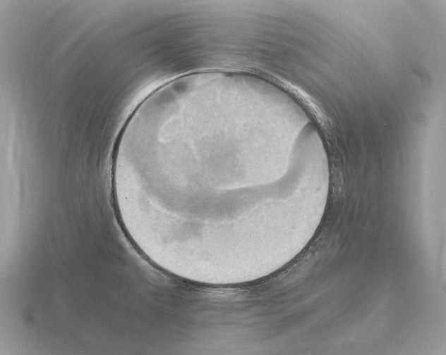 X0000115371479200912151408