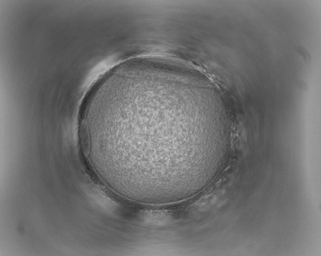 X0000115380296200911171441