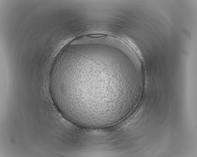 X0000115380385200911171440