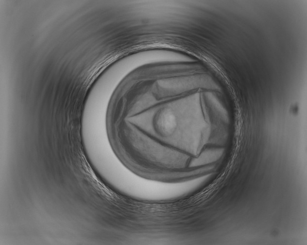 X0000115380793200912011204