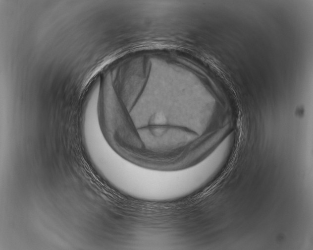 X0000115381165200912011158