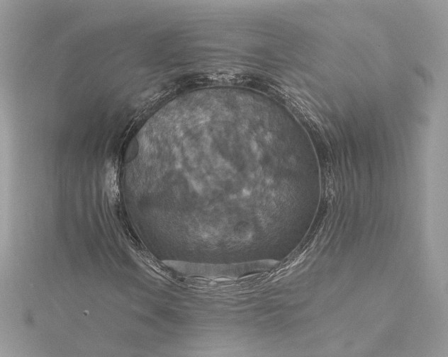 X0000115391106200911171450